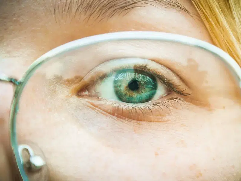 Agora é lei, a pessoa com visão monocular é considerada pessoa com deficiência.
